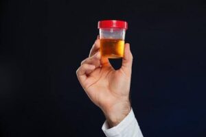 O que pode causar sangue na urina masculina 
