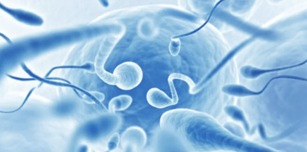 Azoospermia Afeta a Fertilidade Masculina.